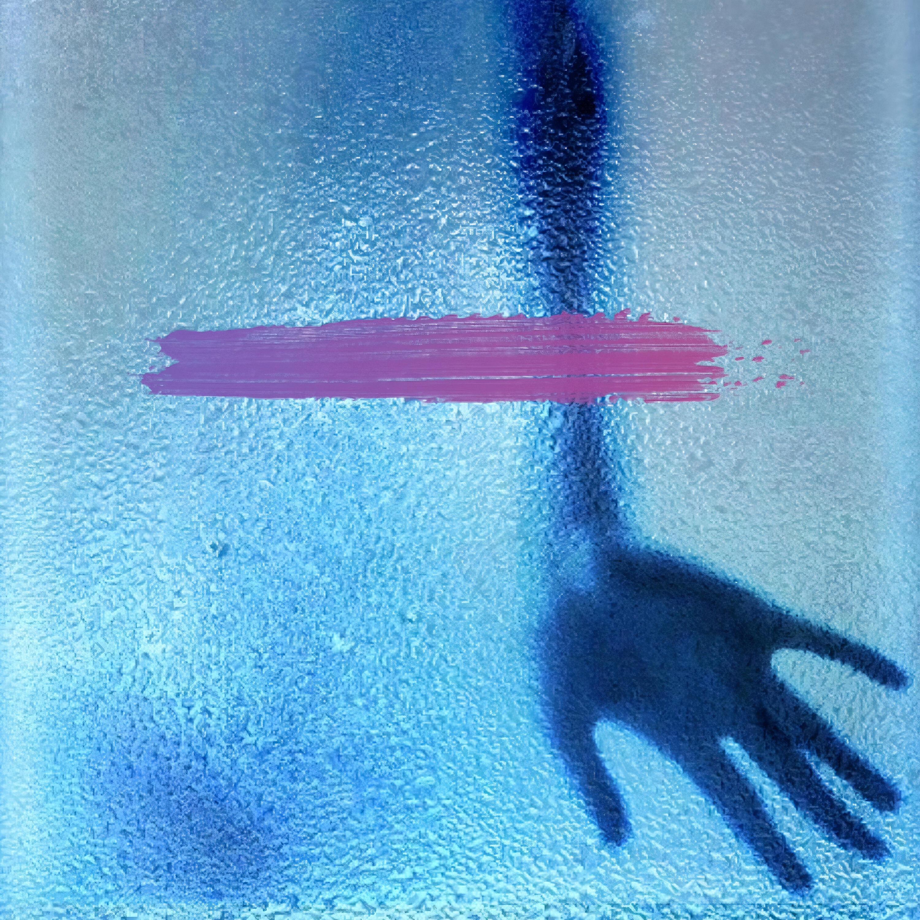 AXVL