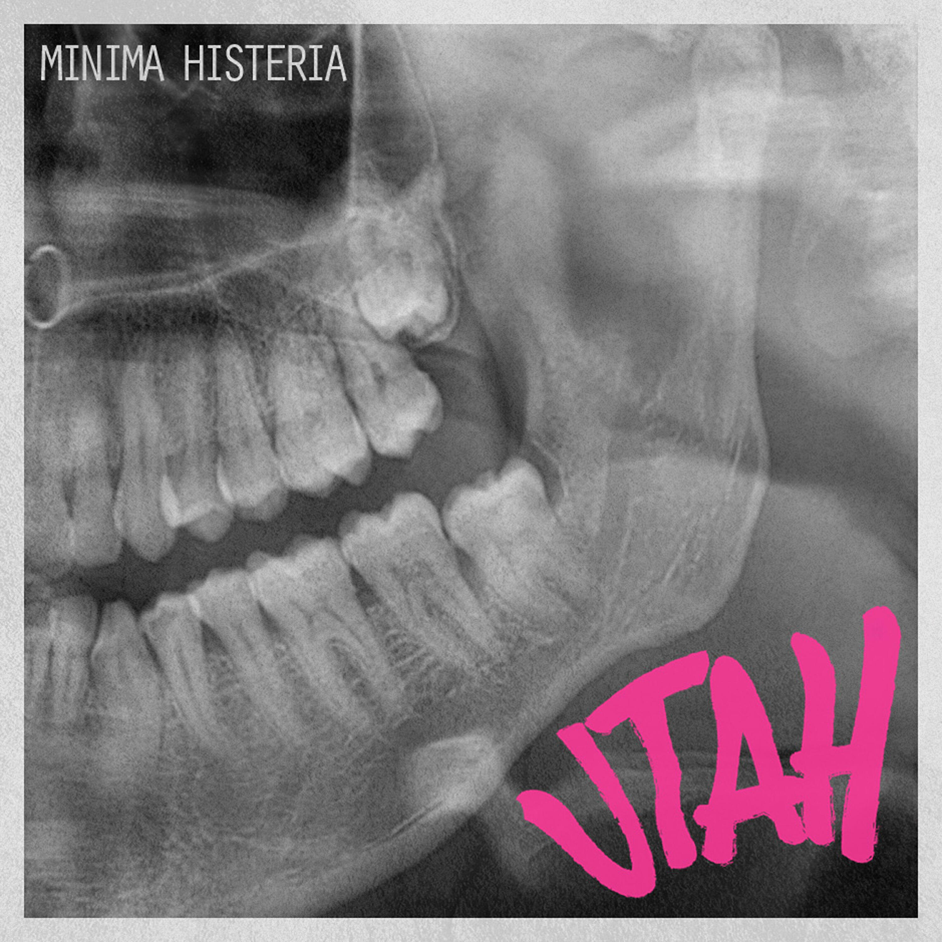Релиз Mínima Histeria