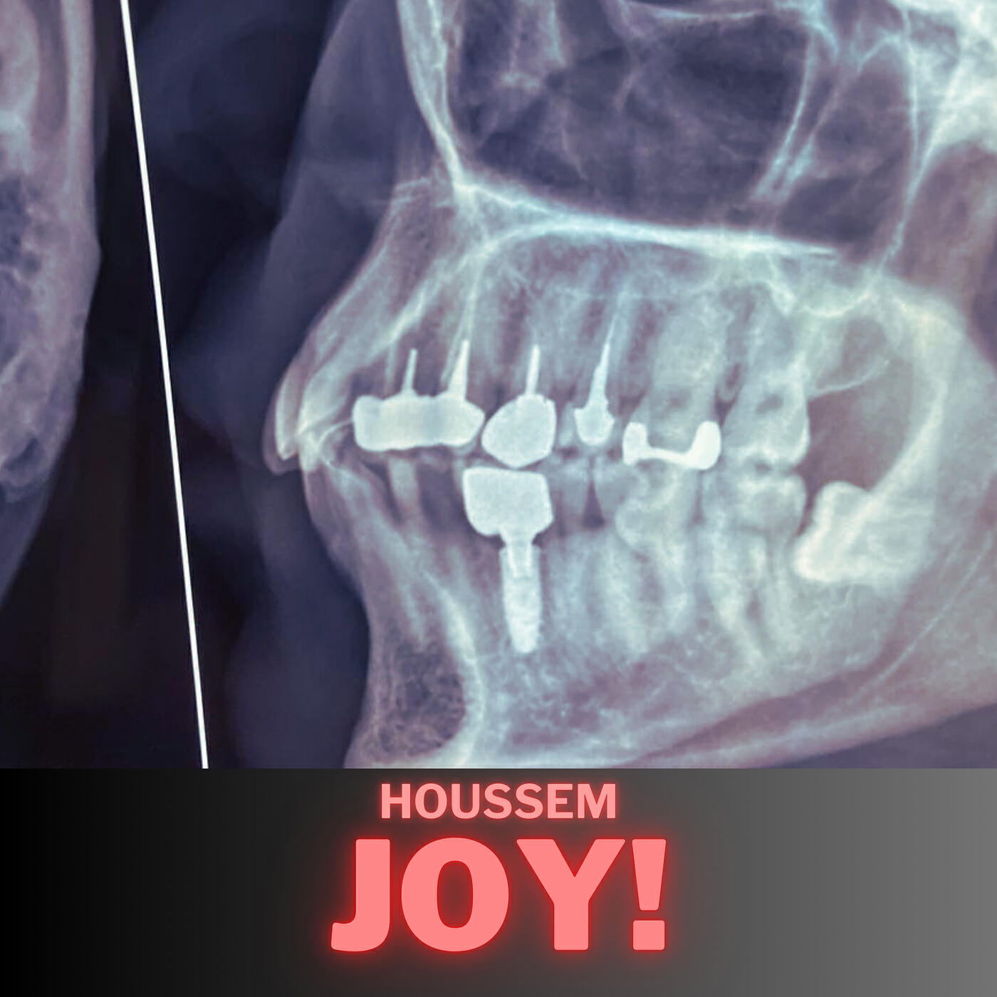 Релиз Joy! - EP