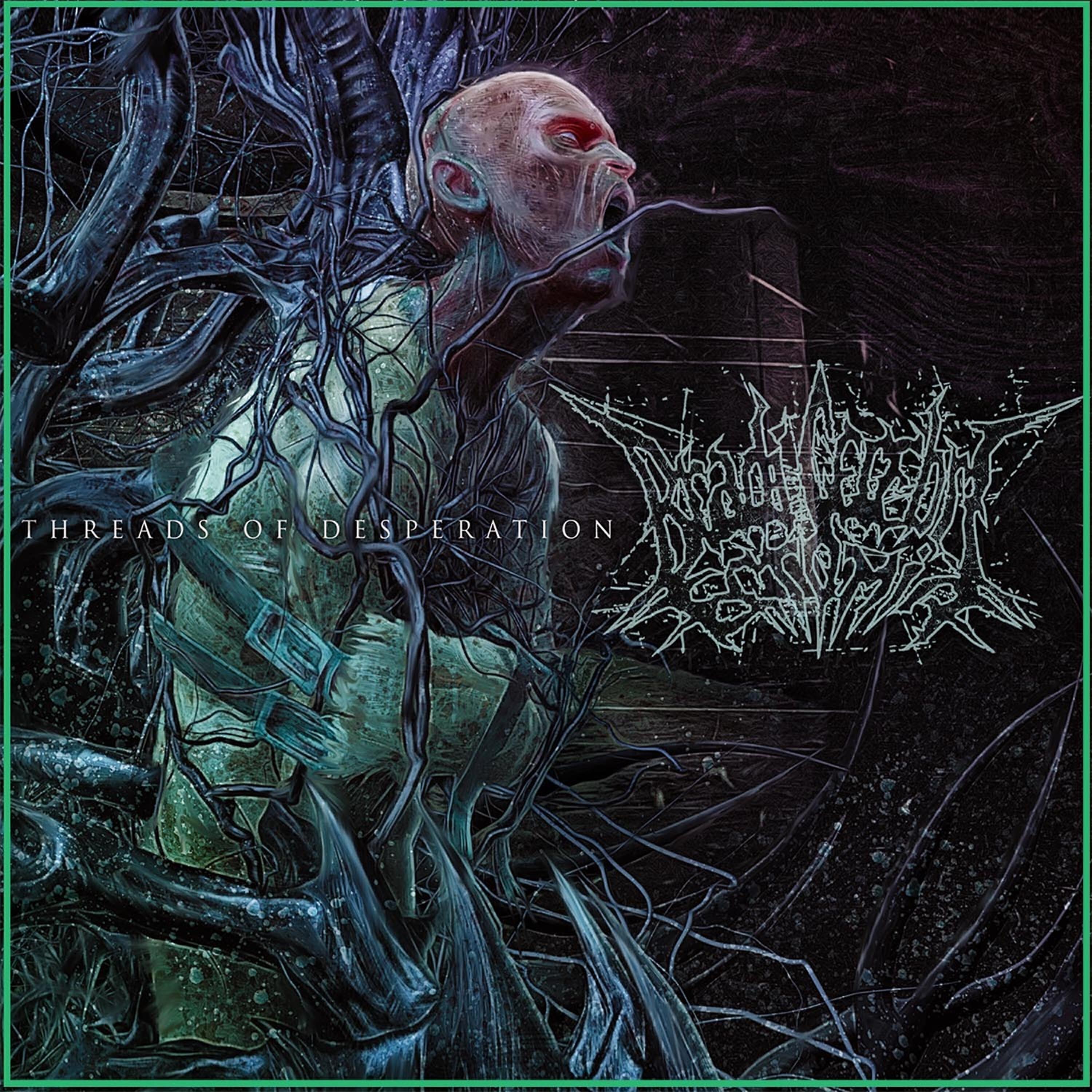 Bradi Cerebri Ectomia