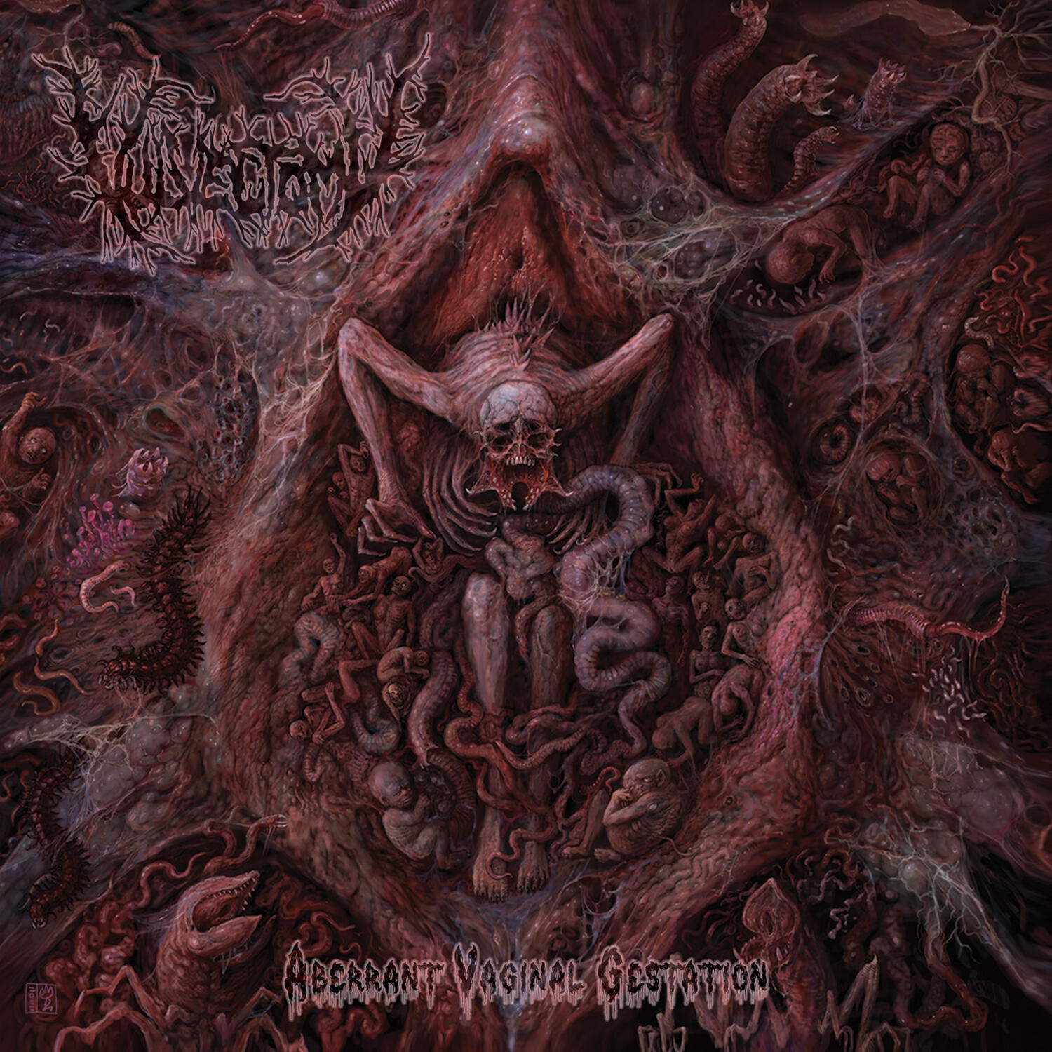 Релиз Aberrant Vaginal Gestation