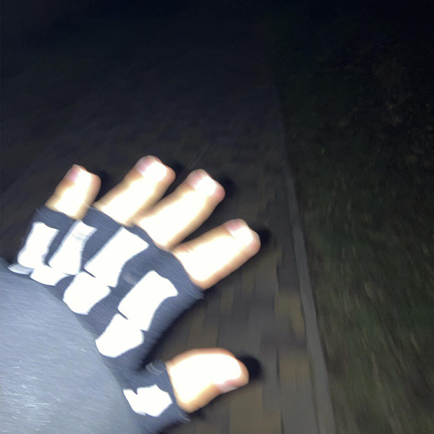 Релиз Травмы