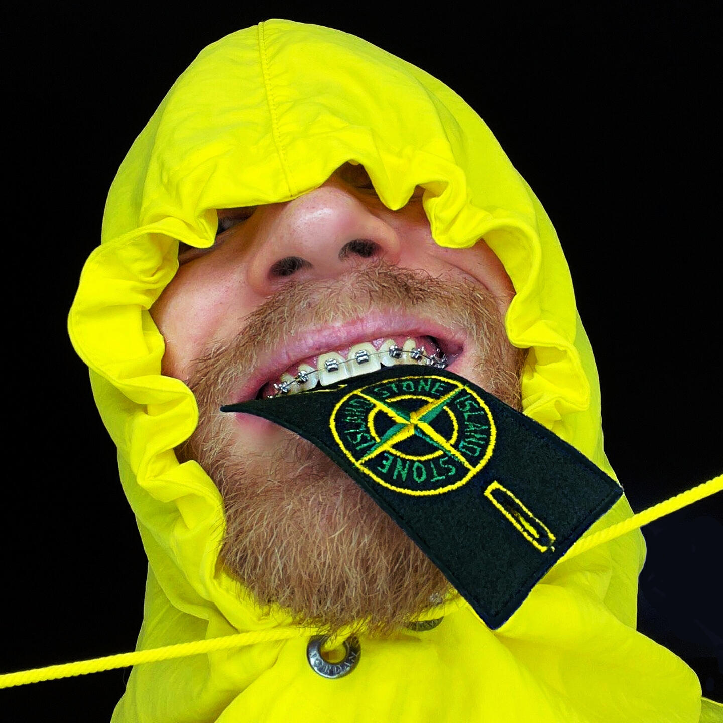 Релиз Запрети мне носить Stone Island