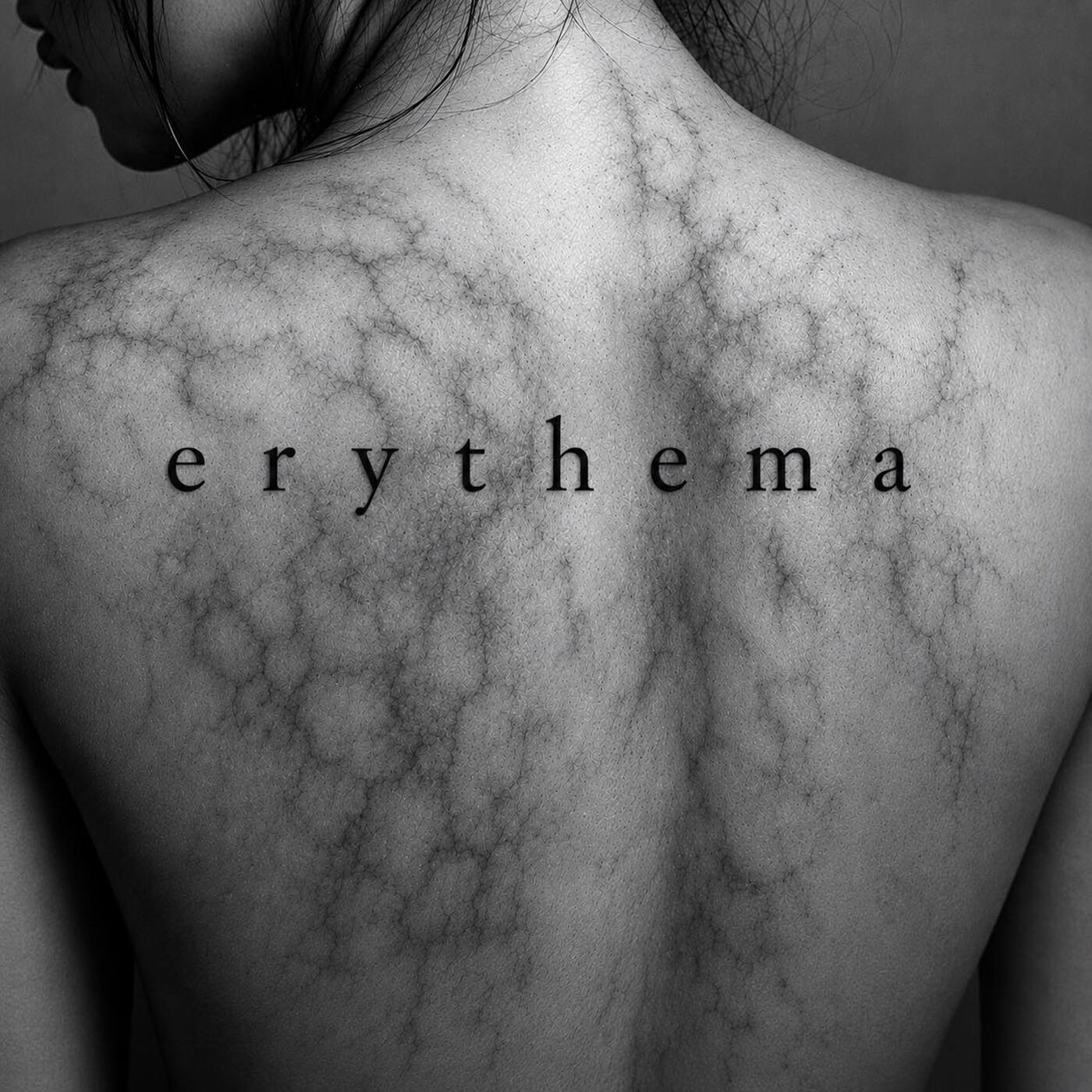 Релиз Erythema