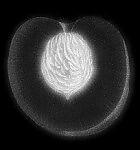 Auricular