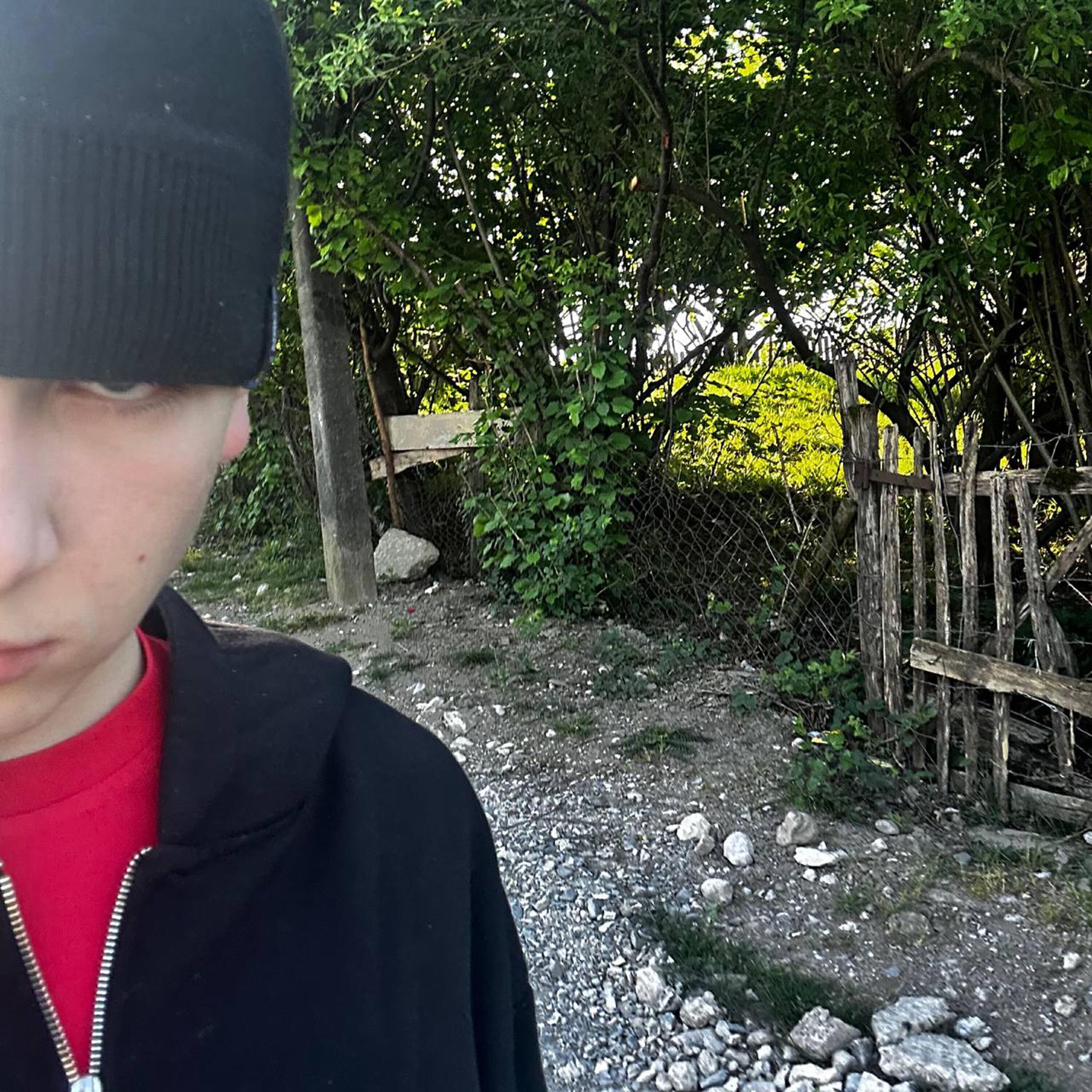 токсис