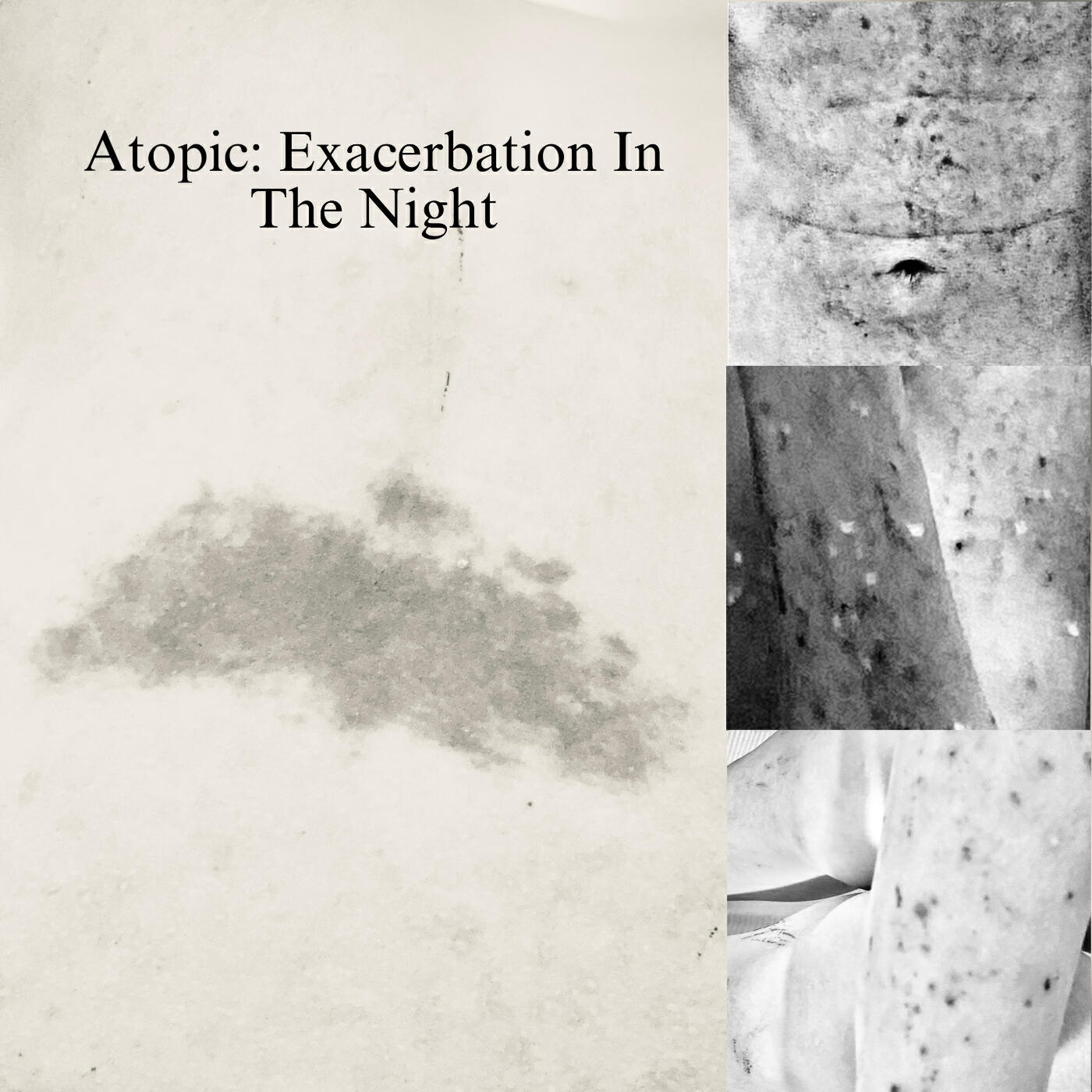 Релиз Atopic: Exacerbation In The Night