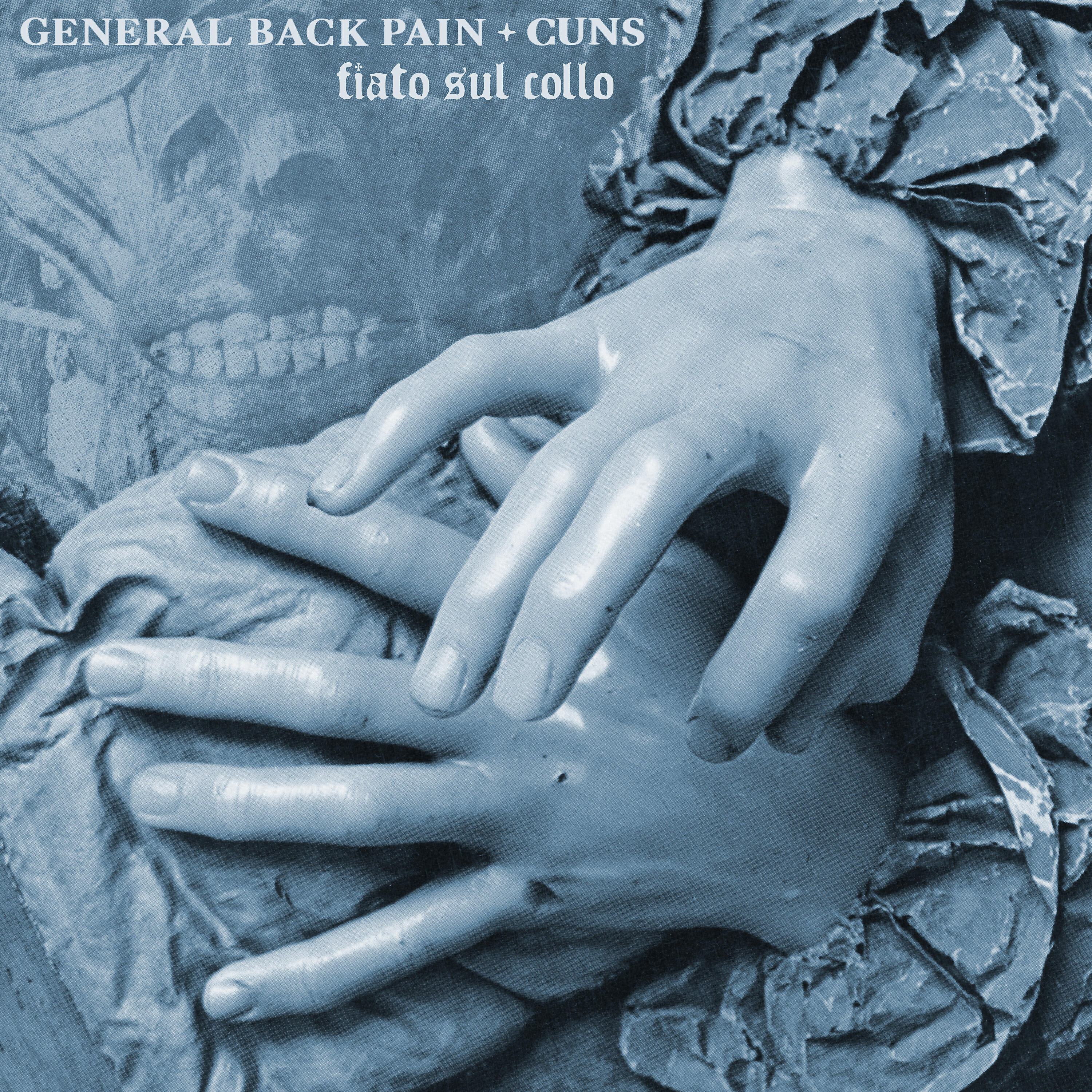 General Back Pain