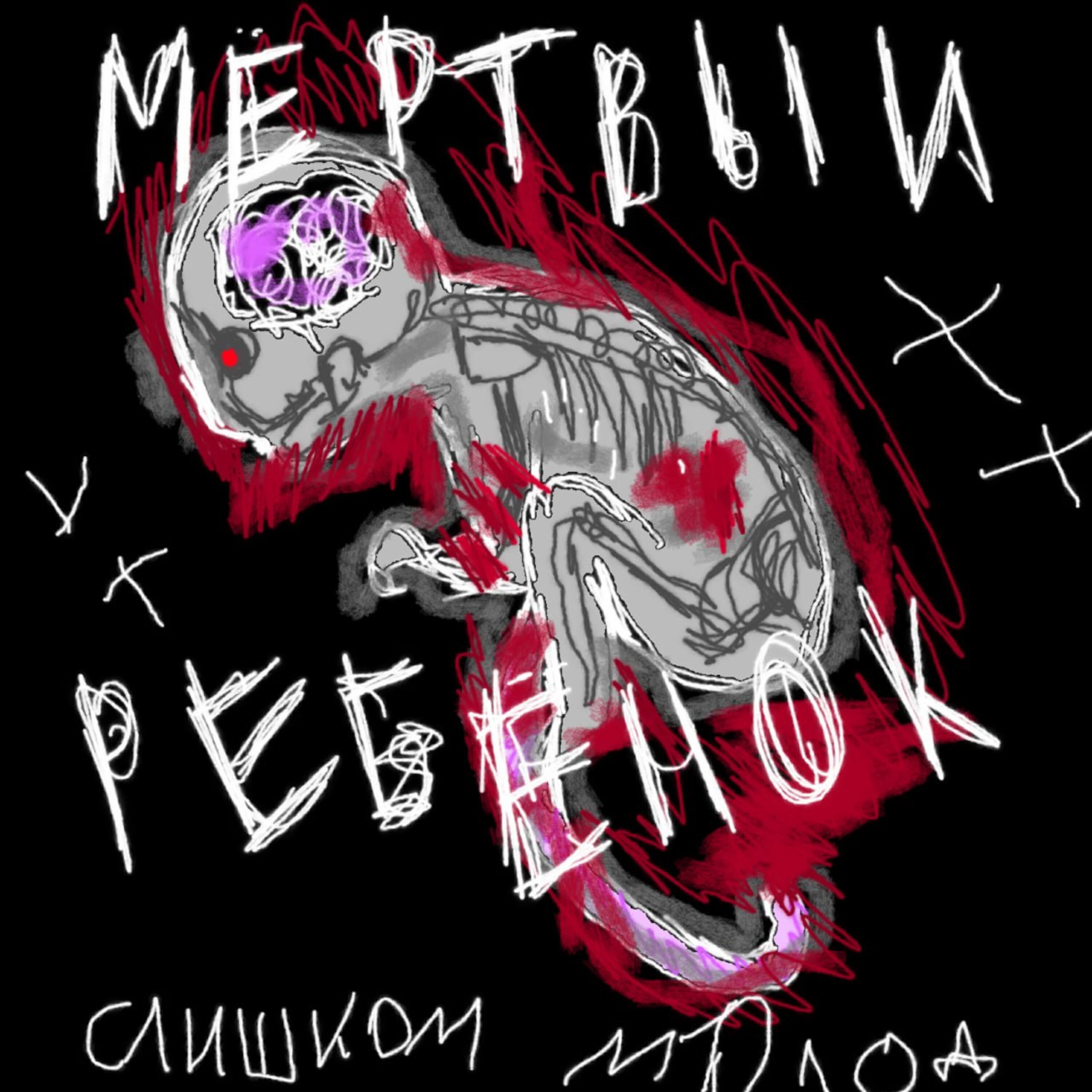 Релиз мёртвый ребёнок