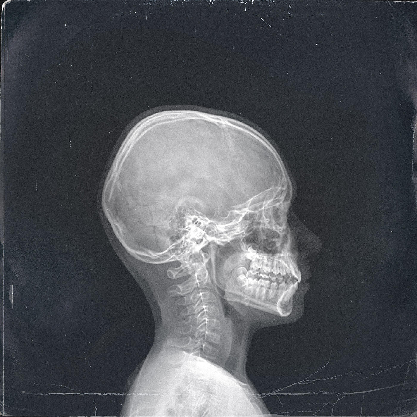 Релиз Doxycycline